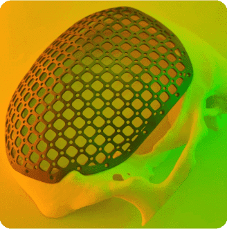 пластина  краніопластина дефект черепа 3D-друк 3д друк київ україна анатомічна модель 3D Metal Tech медичний друк медични 3д вироби ми друкуємо метал українська медицина