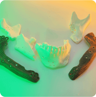 Реконструкція нижньої щелепи імплантат виготовлений на 3D-принтері 3Д протез щелепа роздроблена на частини рішення допомога відновлення щелепи